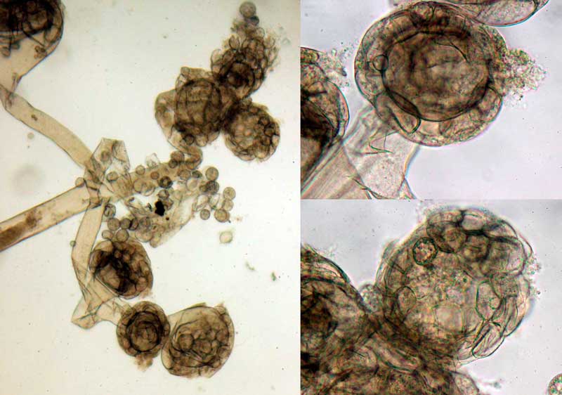 Esporangioesporas.jpg